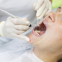 Patient undergoing dental checkup 