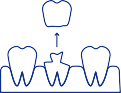 Animated smile with knocked out dental crown