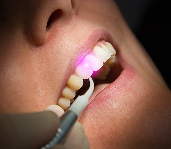 Patient receiving soft tissue laser dentistry