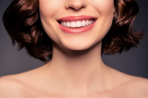 woman with veneers