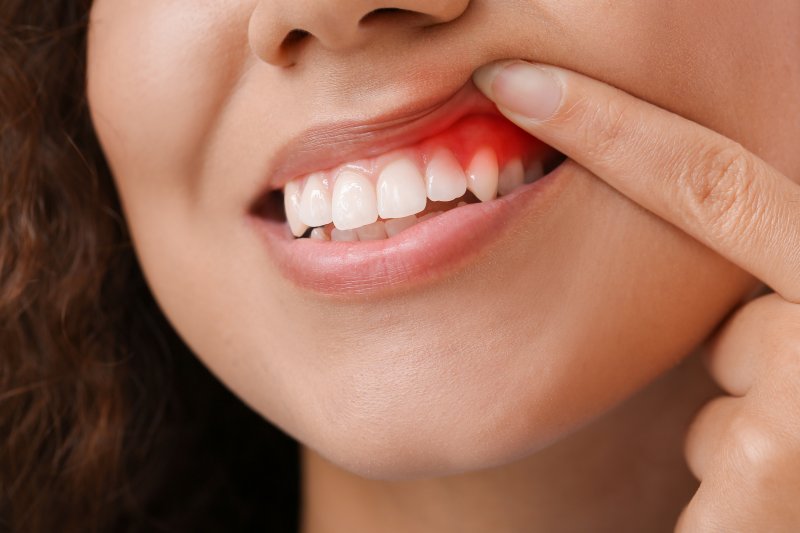 patient with gum disease