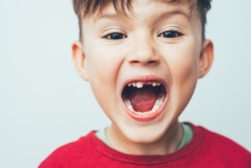 little kid with a missing tooth